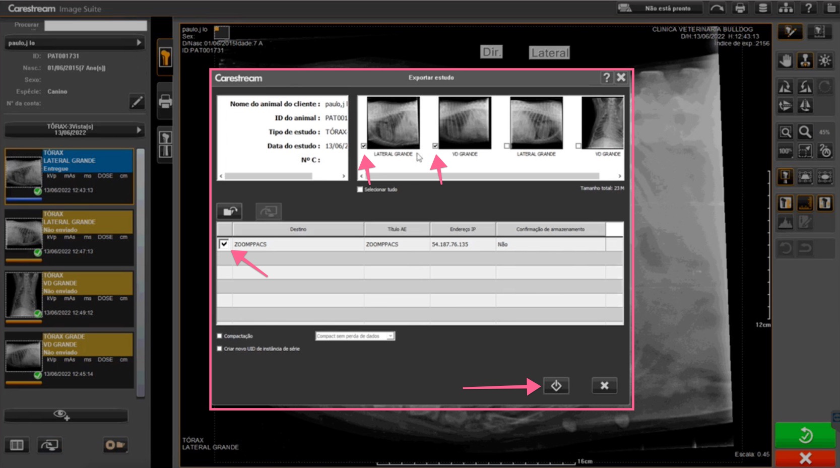 Export Study window with images selected, ZOOMPPACS destination checked and send button highlighted