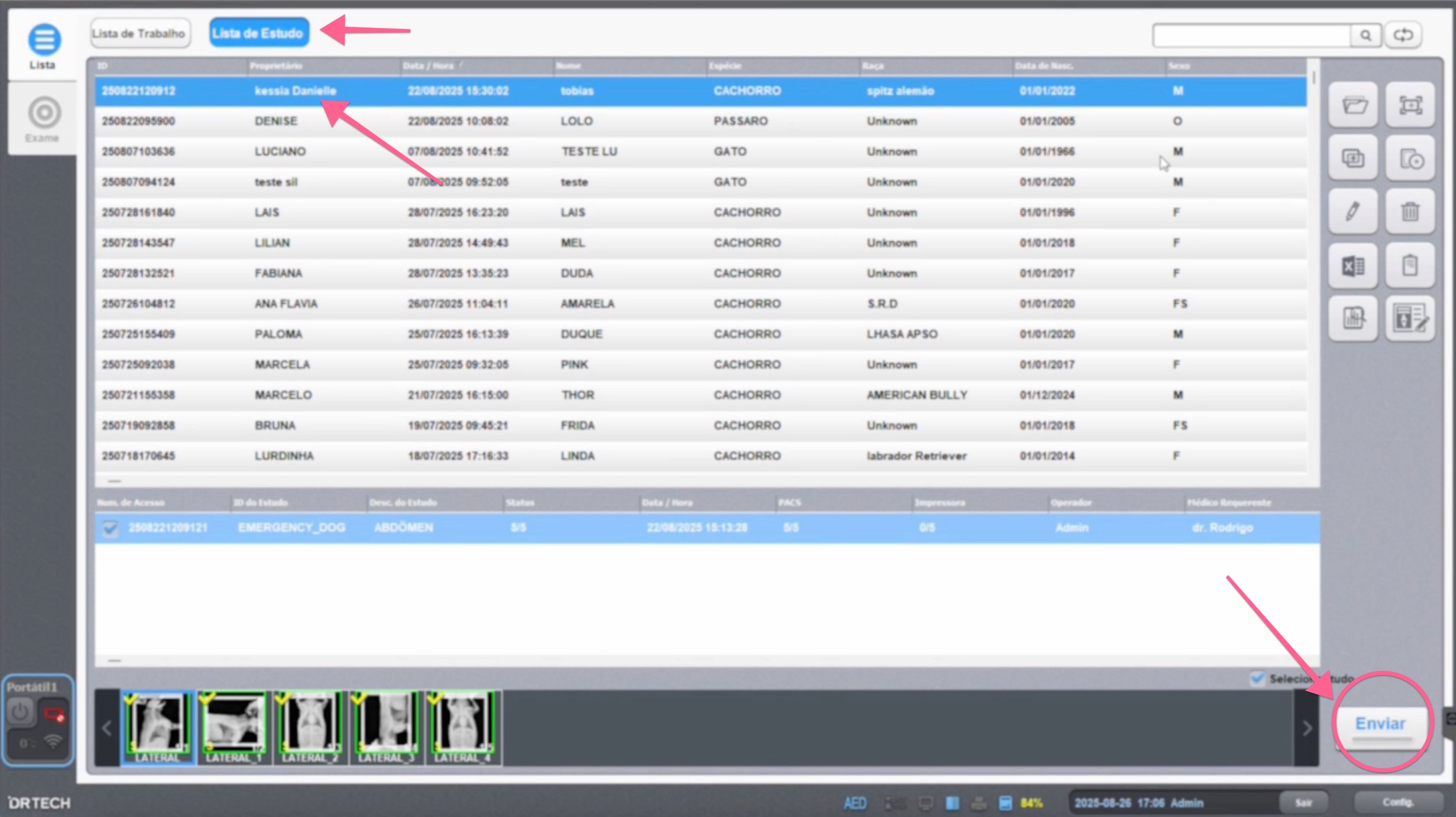 Study List with patient selected and Send button highlighted in the lower-right corner