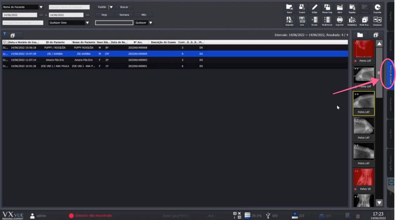 Study screen with the Database tab highlighted in the right sidebar
