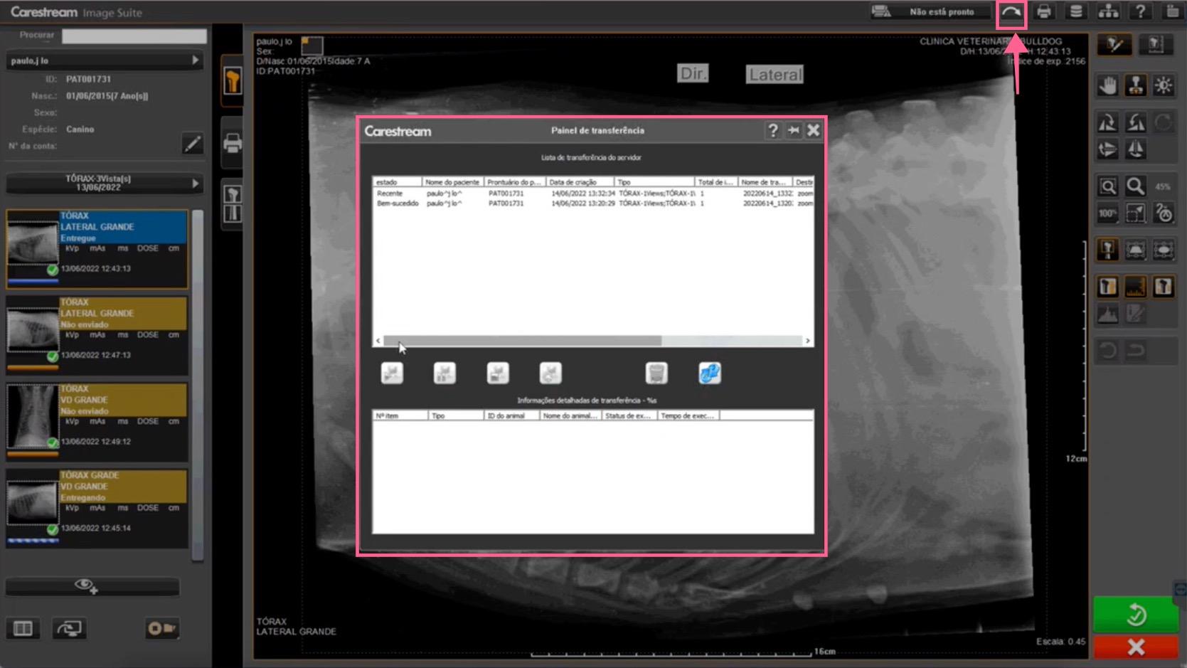 Painel de transferência mostrando estudos com status "Recente" e "Bem-sucedido"